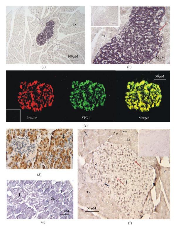 Stanniocalcin-1 co-localizes with insulin in the pancreatic islets.