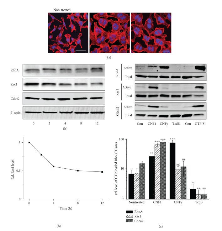 Increased Cell-Matrix Adhesion upon Constitutive Activation of Rho Proteins by Cytotoxic Necrotizing Factors from E. Coli and Y. Pseudotuberculosis.