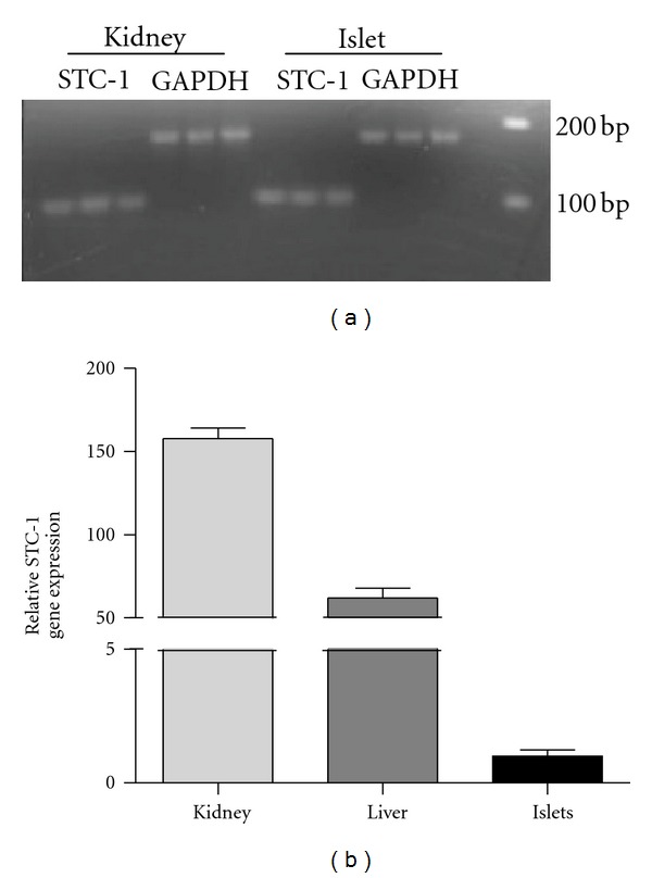 Stanniocalcin-1 co-localizes with insulin in the pancreatic islets.