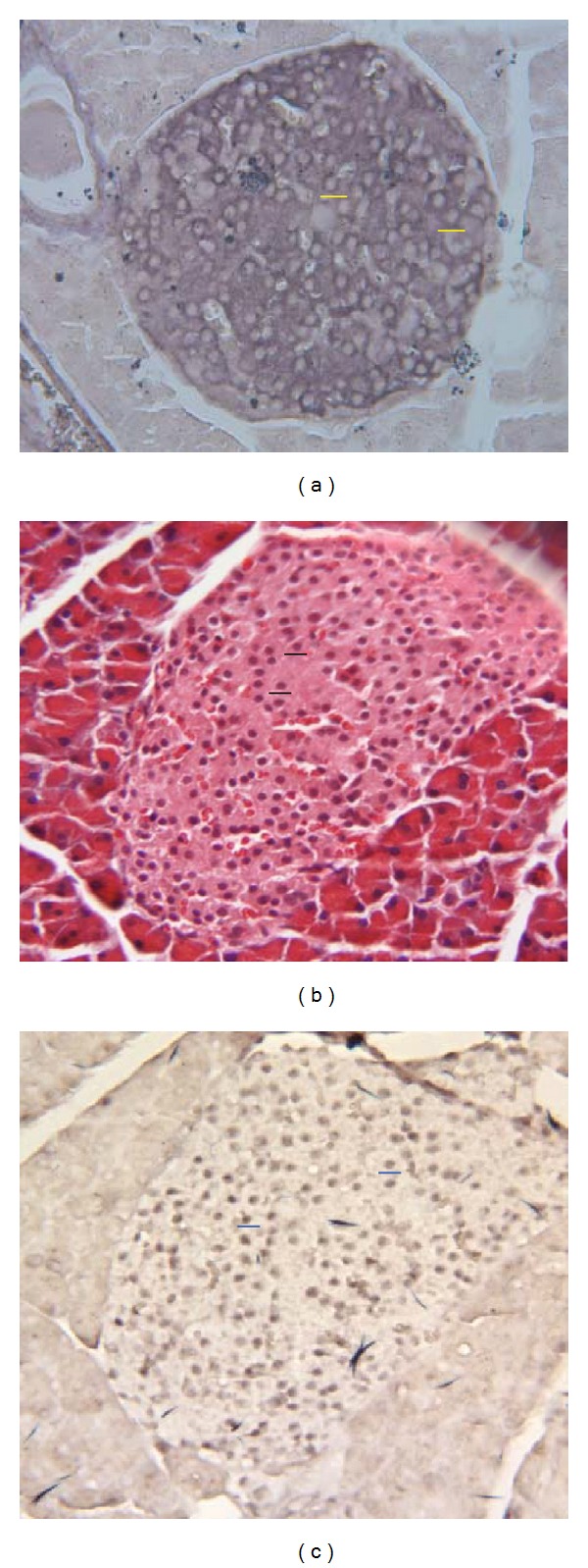 Stanniocalcin-1 co-localizes with insulin in the pancreatic islets.