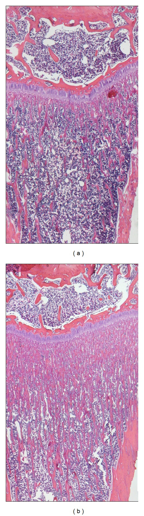 Influence of bisphosphonate treatment on medullary macrophages and osteoclasts: an experimental study.