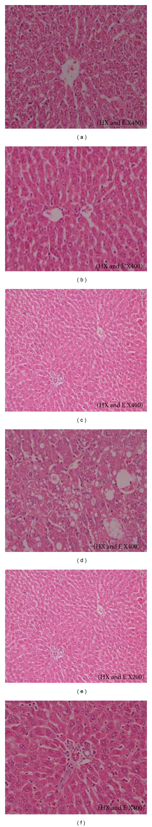 Isoflavones-Enriched Soy Protein Prevents CCL(4)-Induced Hepatotoxicity in Rats.