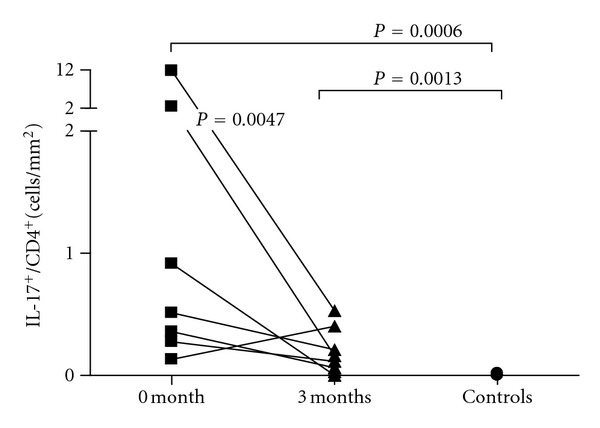 In Crohn's Disease, Anti-TNF-α Treatment Changes the Balance between Mucosal IL-17, FOXP3, and CD4 Cells.