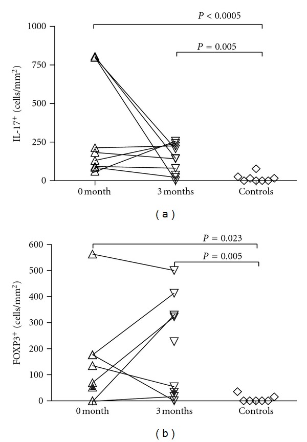 In Crohn's Disease, Anti-TNF-α Treatment Changes the Balance between Mucosal IL-17, FOXP3, and CD4 Cells.