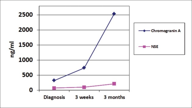 Pure small cell carcinoma of the prostate: A rare tumor.