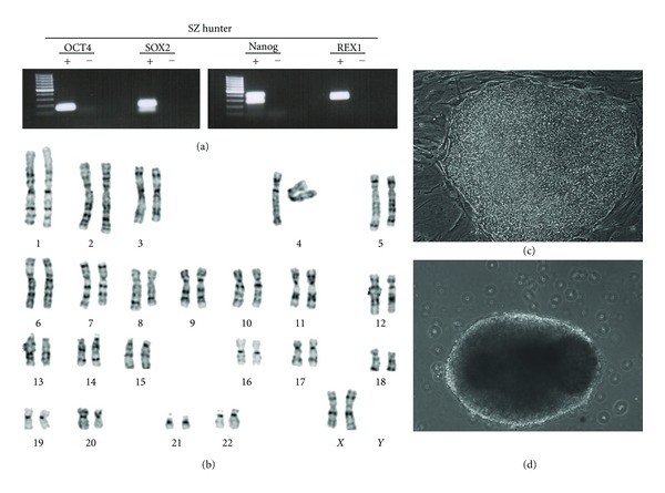 Prevention of lysosomal storage diseases and derivation of mutant stem cell lines by preimplantation genetic diagnosis.