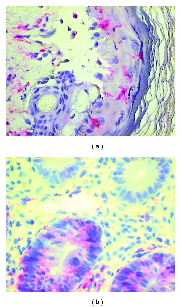 Th17 mediated alloreactivity is facilitated by the pre-transplant microbial burden of the recipient.