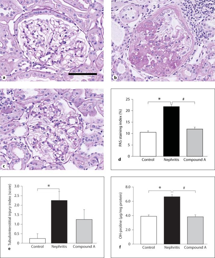 Renoprotective action of a matrix metalloproteinase inhibitor in progressive mesangioproliferative nephritis.