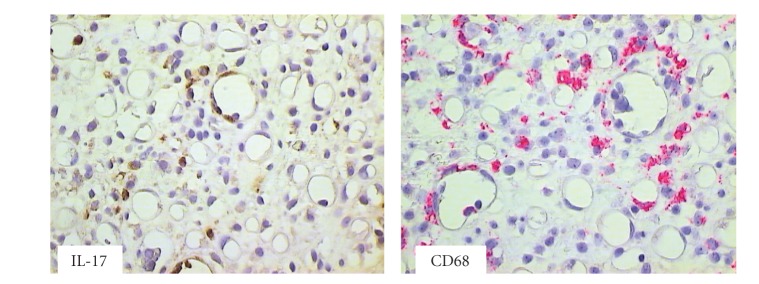 Th17 mediated alloreactivity is facilitated by the pre-transplant microbial burden of the recipient.