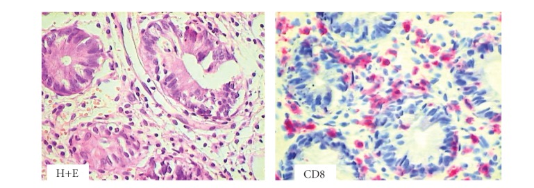 Th17 mediated alloreactivity is facilitated by the pre-transplant microbial burden of the recipient.