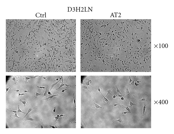 A Novel Cellular Model to Study Angiotensin II AT2 Receptor Function in Breast Cancer Cells.