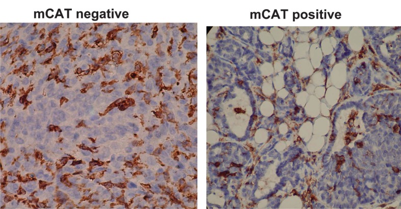 Breast tumors in PyMT transgenic mice expressing mitochondrial catalase have decreased labeling for macrophages and endothelial cells.