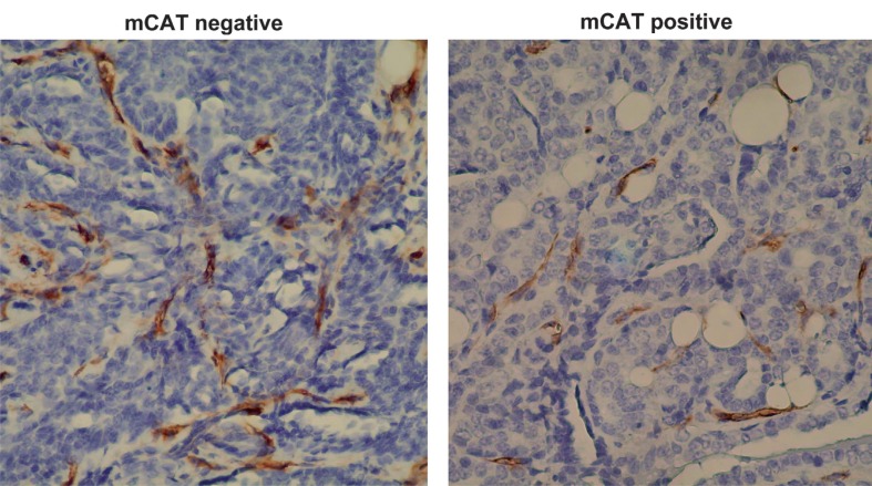 Breast tumors in PyMT transgenic mice expressing mitochondrial catalase have decreased labeling for macrophages and endothelial cells.