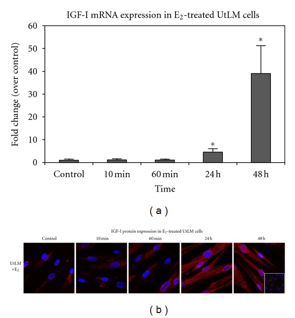 Estrogen Regulates MAPK-Related Genes through Genomic and Nongenomic Interactions between IGF-I Receptor Tyrosine Kinase and Estrogen Receptor-Alpha Signaling Pathways in Human Uterine Leiomyoma Cells.
