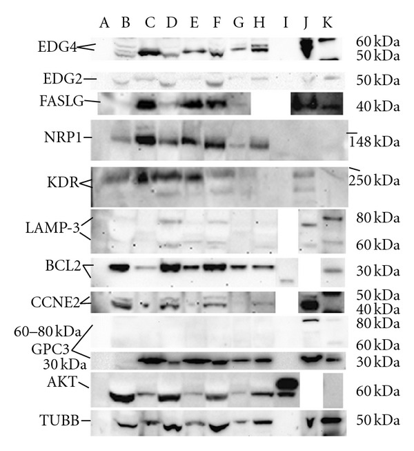 Method for recovery and immunoaffinity enrichment of membrane proteins illustrated with metastatic ovarian cancer tissues.