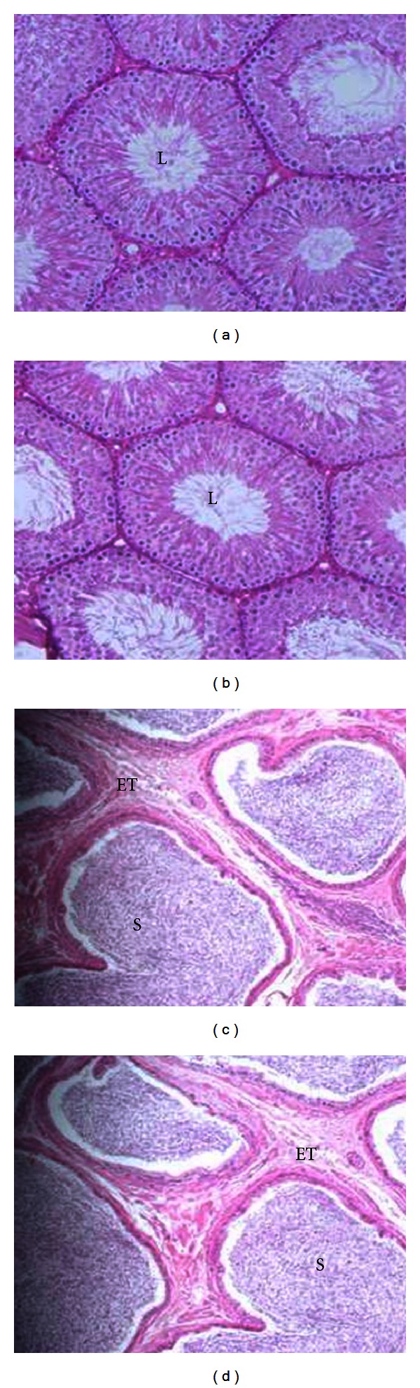 Effect of antimicrobial Peptide, nisin, on the reproductive functions of rats.