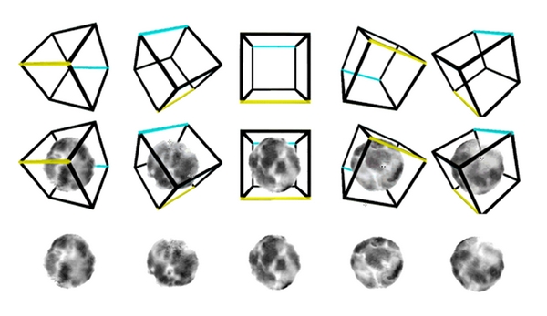 Subcellular Microanatomy by 3D Deconvolution Brightfield Microscopy: Method and Analysis Using Human Chromatin in the Interphase Nucleus.