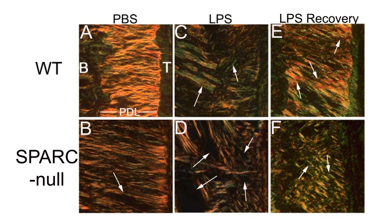 The Function of SPARC as a Mediator of Fibrosis.