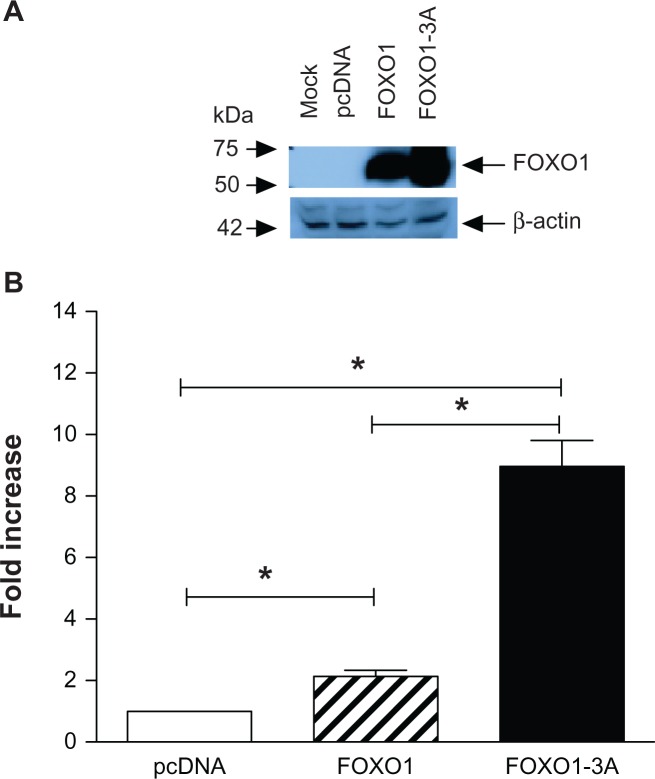 FOXO1 Up-Regulates Human L-selectin Expression Through Binding to a Consensus FOXO1 Motif.