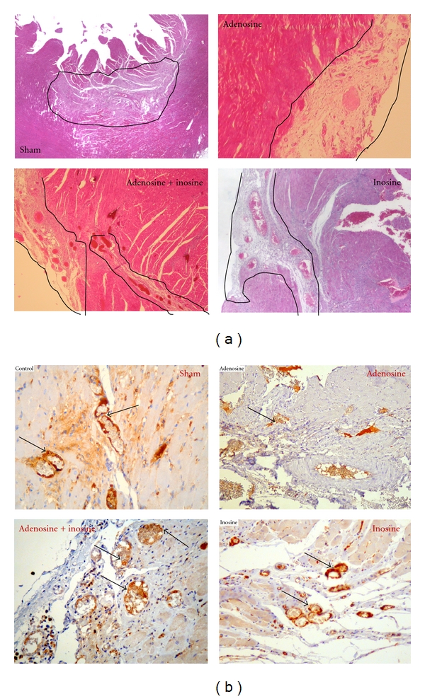 Comparison of the effects of adenosine, inosine, and their combination as an adjunct to reperfusion in the treatment of acute myocardial infarction.