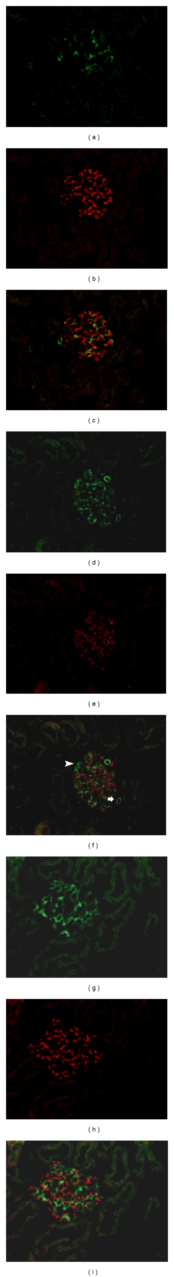 Propyl gallate plays a nephroprotective role in early stage of diabetic nephropathy associated with suppression of glomerular endothelial cell proliferation and angiogenesis.