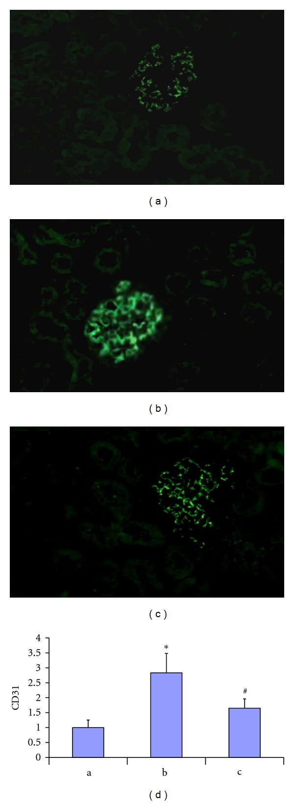 Propyl gallate plays a nephroprotective role in early stage of diabetic nephropathy associated with suppression of glomerular endothelial cell proliferation and angiogenesis.