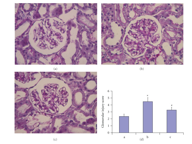 Propyl gallate plays a nephroprotective role in early stage of diabetic nephropathy associated with suppression of glomerular endothelial cell proliferation and angiogenesis.