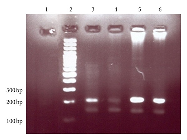 The Prevalence of Human T-Cell lymphotropic Virus Type 1 in Pregnant Women and Their Newborns.