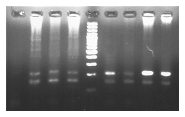 The Prevalence of Human T-Cell lymphotropic Virus Type 1 in Pregnant Women and Their Newborns.