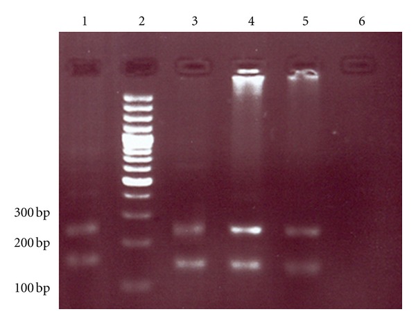 The Prevalence of Human T-Cell lymphotropic Virus Type 1 in Pregnant Women and Their Newborns.