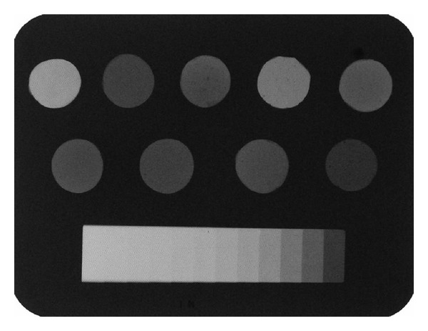 Radiopacity evaluation of contemporary luting cements by digitization of images.