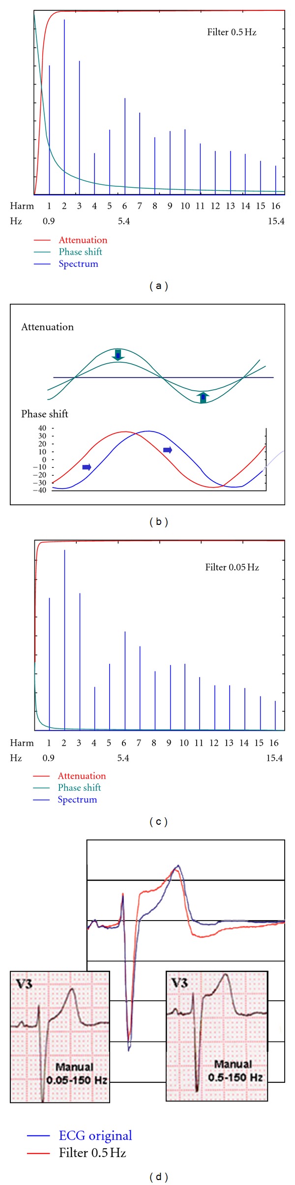 High-Bandpass Filters in Electrocardiography: Source of Error in the Interpretation of the ST Segment.