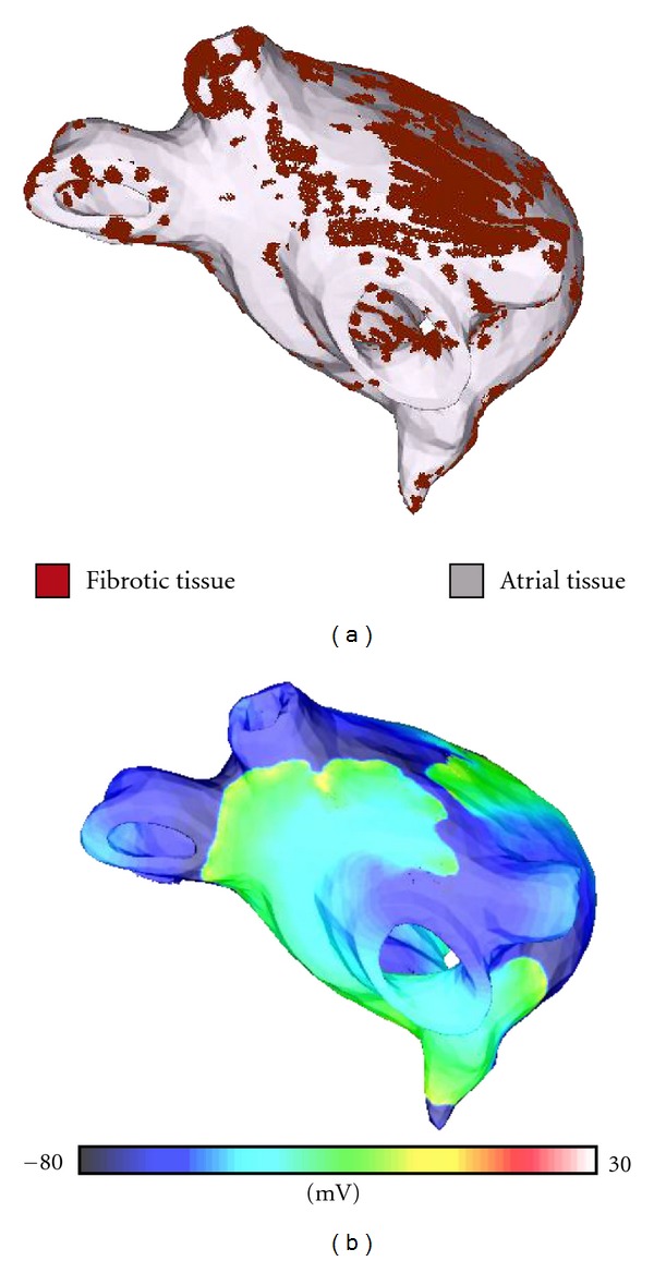 Computational cardiology: the heart of the matter.