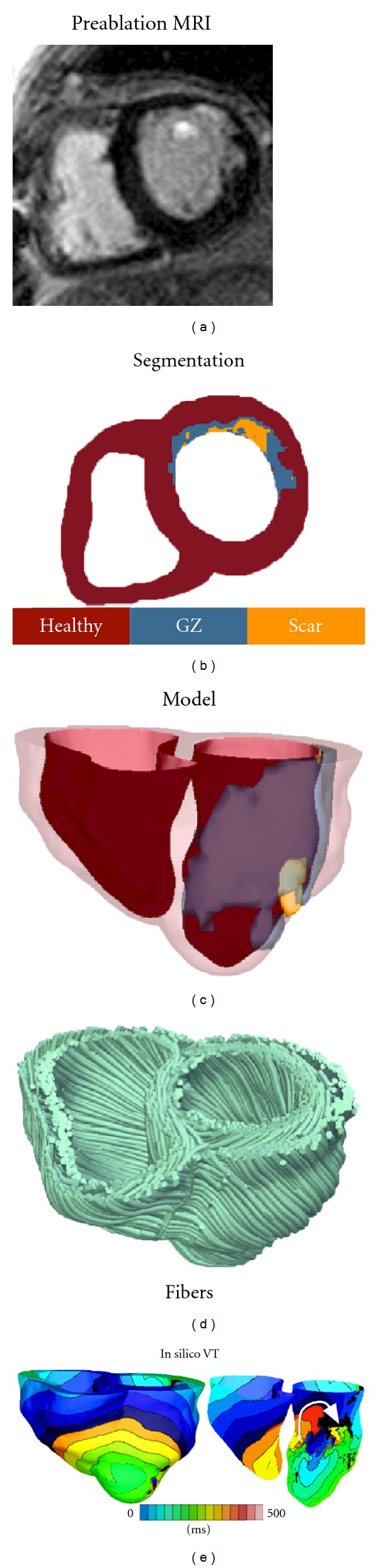 Computational cardiology: the heart of the matter.