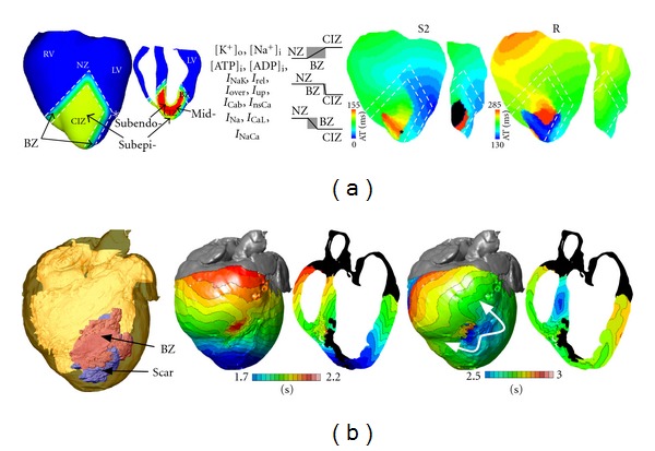 Computational cardiology: the heart of the matter.