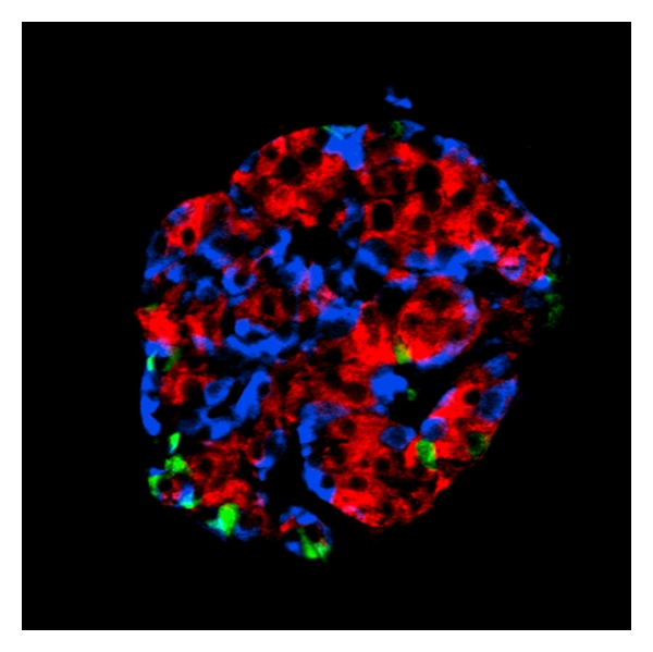 Etiopathogenesis of insulin autoimmunity.