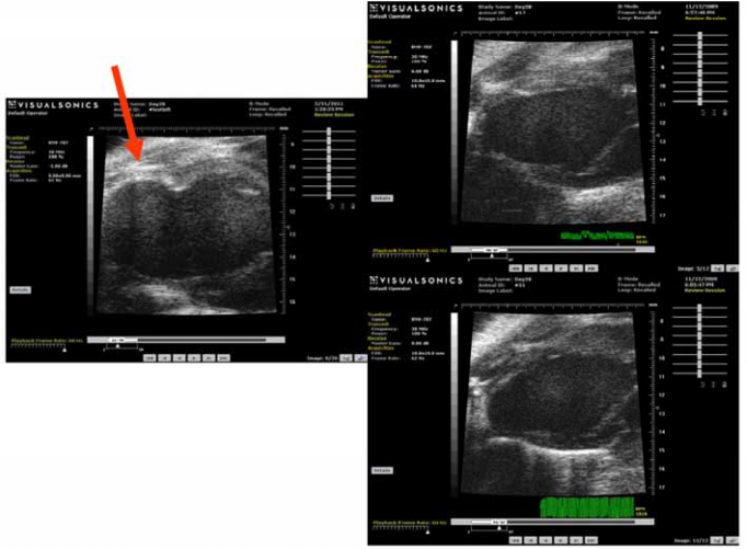 Injection of human bone marrow and mononuclear cell extract into infarcted mouse hearts results in functional improvement.
