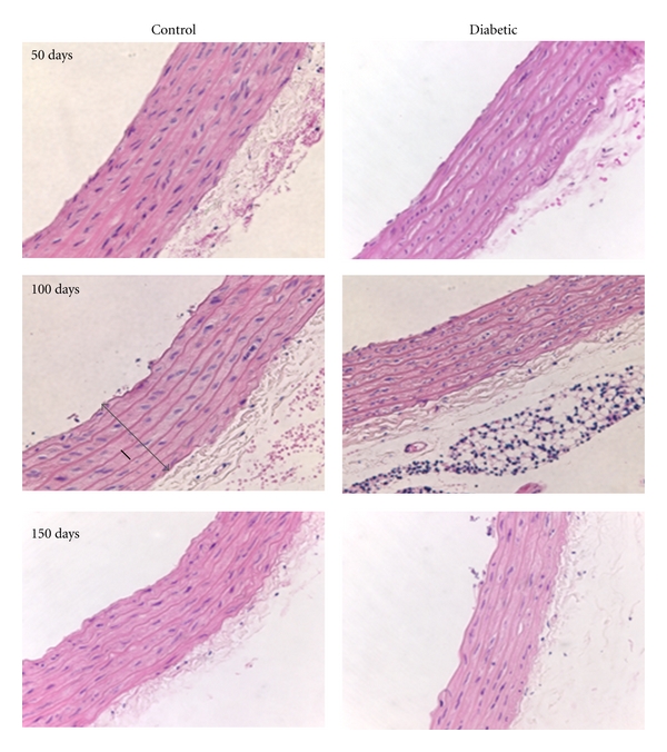 Time-dependent alterations in rat macrovessels with type 1 diabetes.