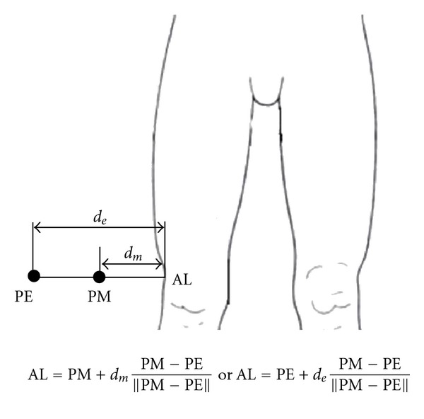 Application of Soft Tissue Artifact Compensation Using Displacement Dependency between Anatomical Landmarks and Skin Markers.