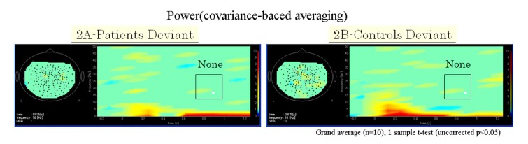 Changes in Event-Related Desynchronization and Synchronization during the Auditory Oddball Task in Schizophrenia Patients.