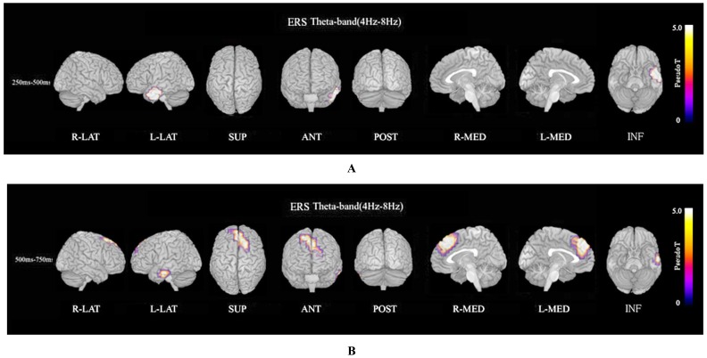 Changes in Event-Related Desynchronization and Synchronization during the Auditory Oddball Task in Schizophrenia Patients.