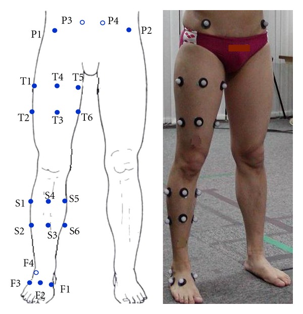 Application of Soft Tissue Artifact Compensation Using Displacement Dependency between Anatomical Landmarks and Skin Markers.
