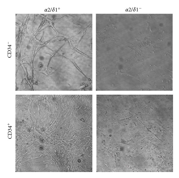 Commitment of Satellite Cells Expressing the Calcium Channel α2δ1 Subunit to the Muscle Lineage.