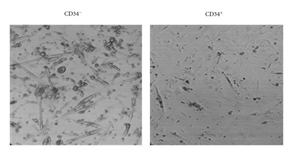 Commitment of Satellite Cells Expressing the Calcium Channel α2δ1 Subunit to the Muscle Lineage.