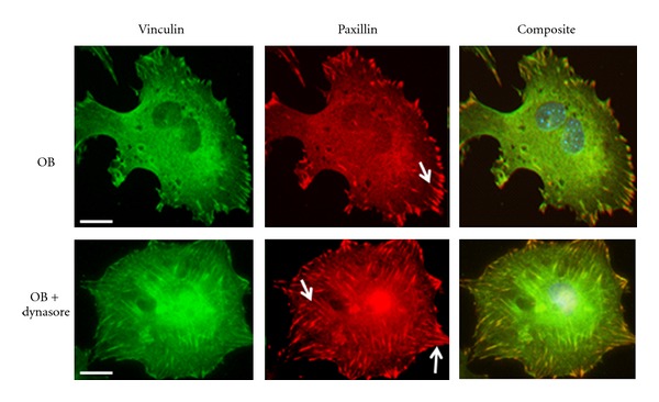 Focal adhesion kinases in adhesion structures and disease.