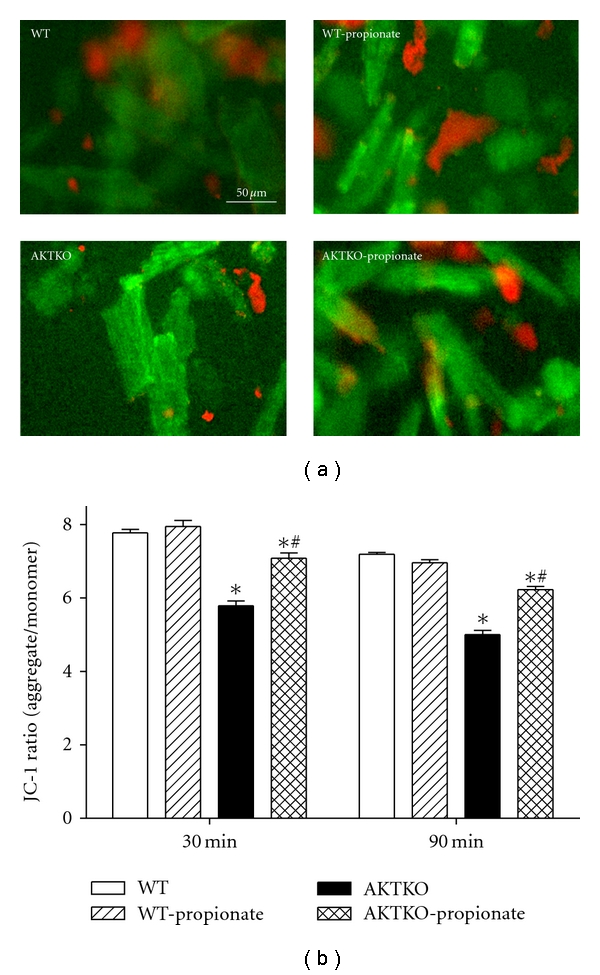 Short-chain fatty acid propionate alleviates Akt2 knockout-induced myocardial contractile dysfunction.