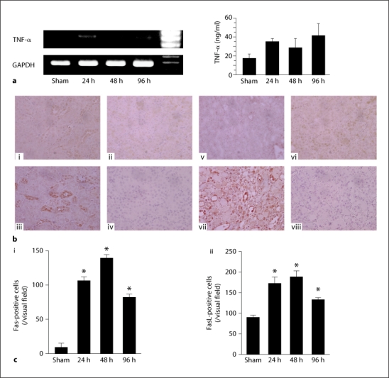 Fas Ligand Has a Greater Impact than TNF-α on Apoptosis and Inflammation in Ischemic Acute Kidney Injury.