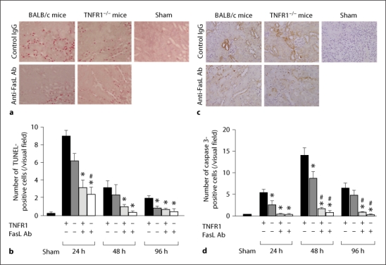 Fas Ligand Has a Greater Impact than TNF-α on Apoptosis and Inflammation in Ischemic Acute Kidney Injury.