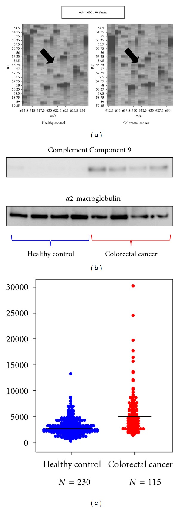 Biomarker Discovery of Pancreatic and Gastrointestinal Cancer by 2DICAL: 2-Dimensional Image-Converted Analysis of Liquid Chromatography and Mass Spectrometry.