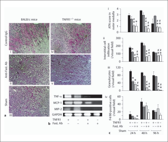 Fas Ligand Has a Greater Impact than TNF-α on Apoptosis and Inflammation in Ischemic Acute Kidney Injury.